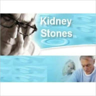 51 Tips for Dealing Kidney Stones - How to Prevent and Treat Kidney Stones eBook Legend Editor