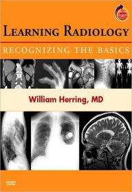 Learning Radiology: Recognizing the Basics, 1st edition William Herring Author