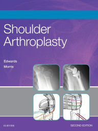Shoulder Arthroplasty E-Book
