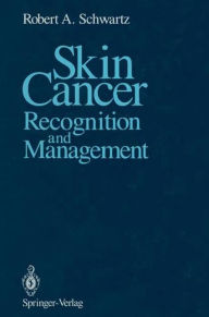 Skin Cancer: Recognition and Management - Robert A. Schwartz