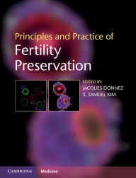 Principles and Practice of Fertility Preservation - Jacques Donnez