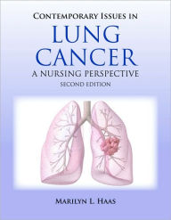 Contemporary Issues in Lung Cancer Marilyn Haas Author