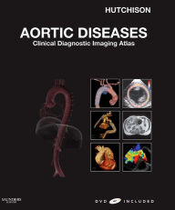 Aortic Diseases E-Book: Clinical Diagnostic Imaging Atlas Stuart J. Hutchison MD, FRCPC, FACC, FAHA, FASE, FSCMR, FSCCT Author