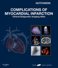 Complications of Myocardial Infarction E-Book: Clinical Diagnostic Imaging Atlas - Stuart J. Hutchison