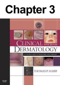 Eczema and Hand Dermatitis: Chapter 3 of Clinical Dermatology - Thomas Habif