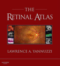 SPEC - The Retinal Atlas, 1st Edition, 12-Month Access, eBook: Expert Consult - Online and Print - Lawrence A. Yannuzzi MD