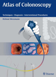 Atlas of Colonoscopy: Examination Techniques and Diagnosis - Helmut Messmann