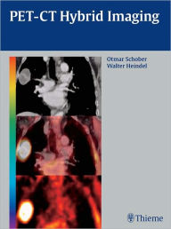 PET-CT Hybrid Imaging - Otmar Schober