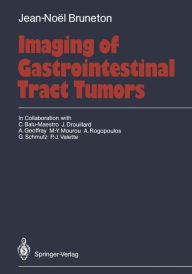 Imaging of Gastrointestinal Tract Tumors