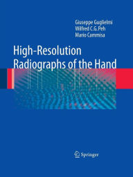 High-Resolution Radiographs of the Hand Giuseppe Guglielmi Author