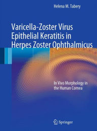 Varicella-Zoster Virus Epithelial Keratitis in Herpes Zoster Ophthalmicus: In Vivo Morphology in the Human Cornea Helena M. Tabery Author