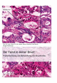 Der Feind in deiner Brust. FrÃ¼herkennung und Behandlung von Brustkrebs: FrÃ¼herkennung und Behandlung von Brustkrebs Prof. Dr. med. Hans E. W. W. Sac