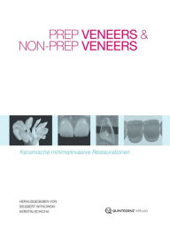 Prep Veneers und Non-Prep Veneers: Keramische minimalinvasive Restaurationen Siegbert Witkowski Author