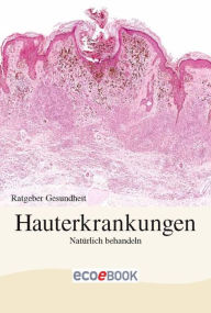 Hauterkrankungen - Natürlich behandeln: Ratgeber Gesundheit Red. Serges Verlag Author