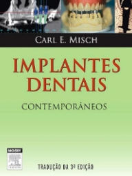 Implantes Dentais Contemporâneos - Carl Misch