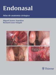 Endonasal: Atlas de anatomia cirúrgica Miguel Tepedino Author