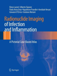 Radionuclide Imaging of Infection and Inflammation: A Pictorial Case-Based Atlas Elena Lazzeri Author
