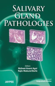 Salivary Gland Pathologies Nisheet Anant Agni Author
